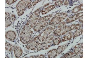 Immunoperoxidase of monoclonal antibody to RPS6KA6 on formalin-fixed paraffin-embedded human stomach. (RPS6KA6 抗体  (AA 636-745))