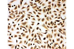 ICC testing of Smad2 antibody and HeLa cells (SMAD2 抗体  (N-Term))