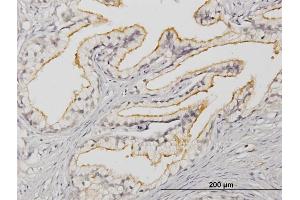 Immunoperoxidase of monoclonal antibody to APOB48R on formalin-fixed paraffin-embedded human prostate. (APOBR 抗体  (AA 71-170))