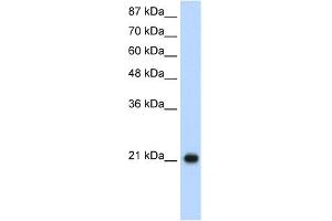 WB Suggested Anti-RPL9 Antibody Titration:  1. (RPL9 抗体  (C-Term))