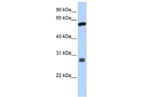 WB Suggested Anti-ACD Antibody Titration: 0. (ACD 抗体  (C-Term))