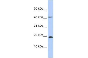 WB Suggested Anti-SFRS12IP1 Antibody Titration: 0. (SFRS12IP1 抗体  (Middle Region))