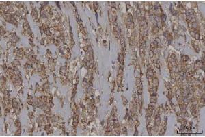 IHC analysis of STON1 using anti-STON1 antibody (ABIN7599896).