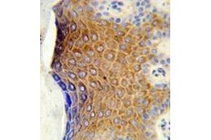 Immunohistochemistry analysis in formalin-fixed and paraffin-embedded human skin tissue reacted with GALNT3 Antibody (Center) followed which was peroxidase-conjugated to the secondary antibody, followed by DAB staining. (GALNT3 抗体  (Middle Region))