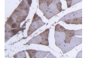 Detection of MYO in Mouse Skeletal muscle Tissue using Polyclonal Antibody to Myoglobin (MYO) (Myoglobin 抗体  (AA 1-154))