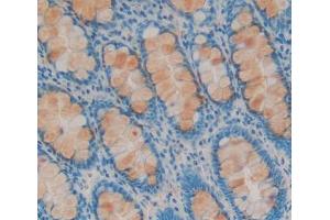 #VALUE! (MED1 抗体  (AA 1-212))