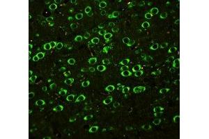 IF: SSH3BP1 antibody testing of rat brain tissue (ABI1 抗体  (C-Term))