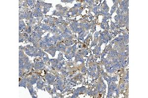 IHC analysis of AFM using anti-AFM antibody (ABIN7601674).