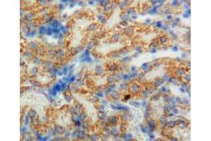 Used in DAB staining on fromalin fixed paraffin-embedded adrenal tissue (CYP11B1 抗体  (AA 1-498))
