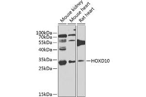 Western blot analysis of extracts of various cell lines, using HOXD10 antibody (ABIN6131767, ABIN6141956, ABIN6141957 and ABIN6223612) at 1:1000 dilution. (HOXD10 抗体  (AA 1-240))