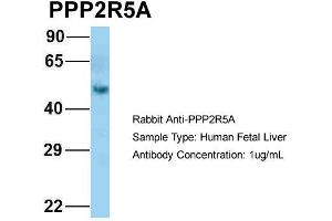 Host: Rabbit Target Name: PPP2R5A Sample Type: Human Fetal Liver Antibody Dilution: 1. (PPP2R5A 抗体  (N-Term))