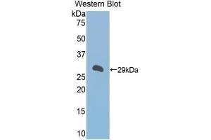 Detection of Recombinant a1BG, Mouse using Polyclonal Antibody to Alpha-1-B-Glycoprotein (a1BG) (A1BG 抗体  (AA 22-219))