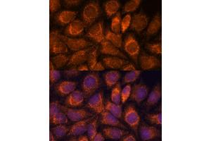 Immunofluorescence analysis of HeLa cells using MRPS14 antibody (ABIN7270013) at dilution of 1:100. (RPS14 抗体  (AA 1-128))