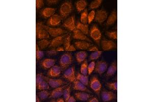 Immunofluorescence analysis of HeLa cells using MRPS14 antibody (ABIN7270013) at dilution of 1:100. (RPS14 抗体  (AA 1-128))