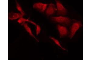 ABIN6269309 staining HeLa by IF/ICC. (E2F1 抗体  (C-Term))