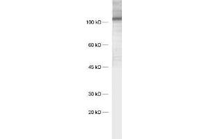 dilution: 1 : 1000, sample: synaptic membrane fraction of rat brain (LP1) (LRFN3 抗体)