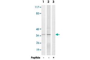 Western blot analysis of extracts from HepG2 cells (Lane 1) and Jurkat cells (Lane 2 and lane 3), using ELOVL1 polyclonal antibody . (ELOVL1 抗体)