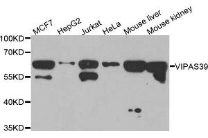 Western blot analysis of extracts of various cell lines, using VIPAS39 antibody. (VIPAR 抗体)