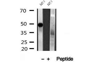 Western blot analysis of extracts of BxPC-3 cells, using PADI2 antibody. (PADI2 抗体  (Internal Region))