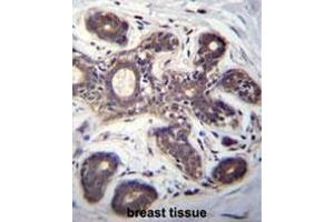 EIF2B1 Antibody (Center) immunohistochemistry analysis in formalin fixed and paraffin embedded human breast tissue followed by peroxidase conjugation of the secondary antibody and DAB staining. (EIF2B1 抗体  (Middle Region))
