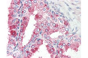 Anti-GPR27 antibody IHC of human prostate. (GPR27 抗体  (Internal Region))