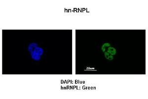Sample Type :  MCF7 cells   Primary Antibody Dilution :   1:200   Secondary Antibody:  Anti-rabbit-FITC   Secondary Antibody Dilution:   1:500   Color/Signal Descriptions:  DAPI: Blue hnRNPL: Green   Gene Name:  HNRPL   Submitted by:  Anonymous