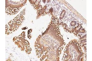 IHC analysis of CDK5 using anti-CDK5 antibody (ABIN6719393). (CDK5 抗体  (AA 1-226))