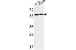 Western blot analysis of FANCC Antibody (C-term) in HL-60,HepG2 cell line lysates (35ug/lane). (FANCC 抗体  (C-Term))