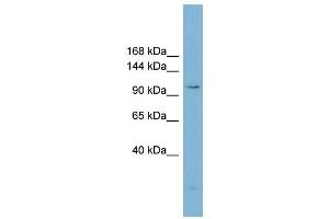 WB Suggested Anti-ACLY  Antibody Titration: 0. (ACLY 抗体  (Middle Region))