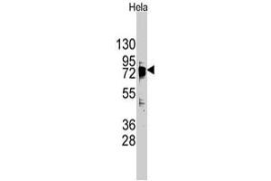 Western blot analysis of DDX3X polyclonal antibody  in HeLa cell line lysates (35 ug/lane).