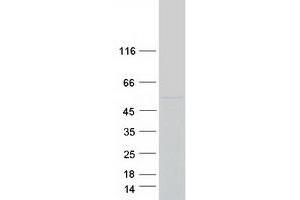 Western Blotting (WB) image for Cytochrome P450, Family 26, Subfamily A, Polypeptide 1 (CYP26A1) (Transcript Variant 1) protein (Myc-DYKDDDDK Tag) (ABIN2712756)