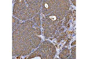 IHC analysis of MRPS22 using anti-MRPS22 antibody (ABIN7600613). (MRPS22 抗体  (AA 21-329))
