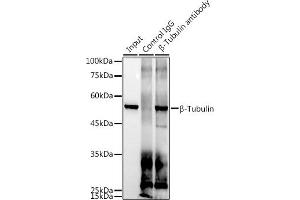Immunoprecipitation analysis of 300 μg extracts of 293T cells using 3 μg β-Tubulin antibody (ABIN7271043). (TUBB 抗体)