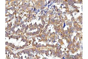 IHC analysis of CCDC115 using anti-CCDC115 antibody (ABIN7599042).