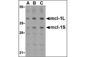 Western blot analysis of Mcl-1 in Raji cell lysates with AP30549PU-N (IN) at (A) 0. (MCL-1 抗体  (Center))