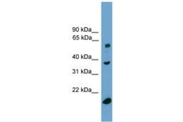 TBL1Y 抗体  (C-Term)