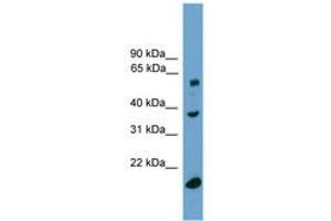 Image no. 1 for anti-Transducin (Beta)-Like 1, Y-Linked (TBL1Y) (C-Term) antibody (ABIN6744913) (TBL1Y 抗体  (C-Term))