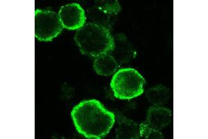 Immunofluorescence (IF) image for anti-HHV6 gQ1 (AA 3-422) antibody (ABIN2452012) (HHV6 gQ1 (AA 3-422) 抗体)