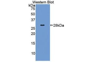Detection of Recombinant COL4a2, Human using Polyclonal Antibody to Collagen Type IV Alpha 2 (COL4a2) (COL4a2 抗体  (AA 1487-1703))