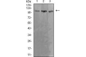 Western blot analysis using ADAR mouse mAb against Ramos (1), K562 (2), and Jurkat (3) cell lysate. (ADAR 抗体  (AA 1085-1223))