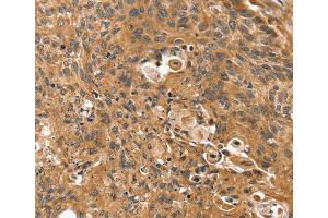 Immunohistochemistry (IHC) image for anti-Synovial Sarcoma, X Breakpoint 2 Interacting Protein (SSX2IP) antibody (ABIN2430871) (SSX2IP 抗体)