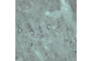 Immunohistochemistry (IHC) image for anti-Vacuolar Protein Sorting 45 (VPS45) antibody (ABIN351329)