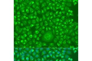 Immunofluorescence analysis of U2OS cells using IFNW1 Polyclonal Antibody at dilution of 1:100. (IFNW1 抗体)
