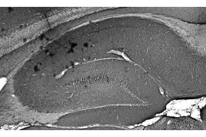 Adult rat hippocampus immunohistochemistry. (GIT1 抗体  (C-Term))