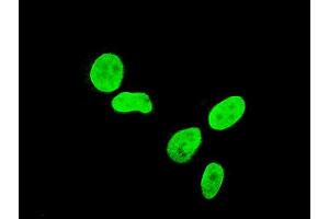 Immunofluorescence of monoclonal antibody to TBX3 on HeLa cell. (TBX3 抗体  (AA 311-410))