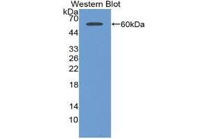 Western blot analysis of the recombinant protein. (AGGF1 抗体  (AA 263-507))