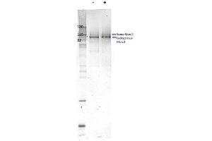 Western Blotting (WB) image for anti-MORC Family CW-Type Zinc Finger 3 (MORC3) antibody (ABIN5596951)