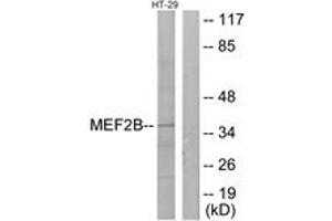 Western blot analysis of extracts from HT-29 cells, using MEF2B Antibody. (MEF2B 抗体  (AA 51-100))