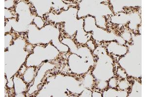 ABIN6269409 at 1/100 staining Rat lung tissue by IHC-P.