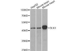 Western blot analysis of extracts of various cell lines, using DLK1 antibody. (DLK1 抗体  (AA 83-383))